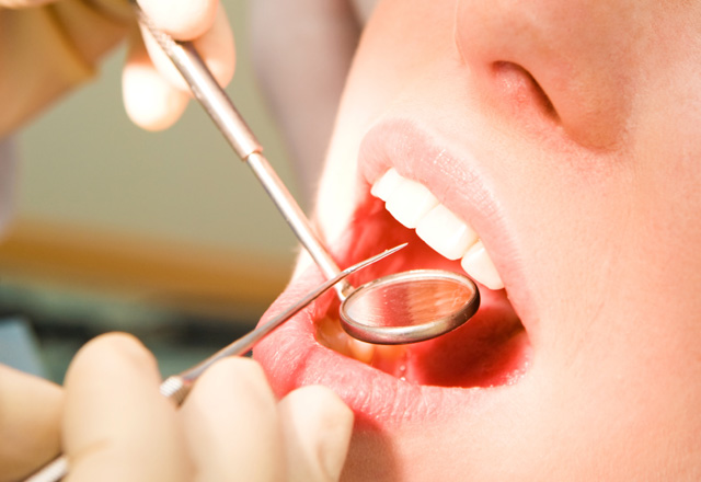 歯周病の進行に合わせた治療