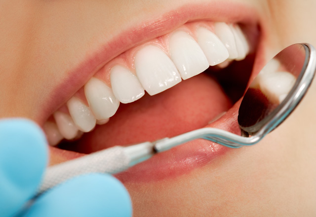 歯周病の進行に合わせた治療
